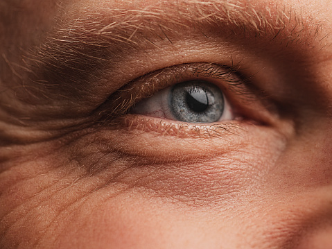 Patient with floater in eye